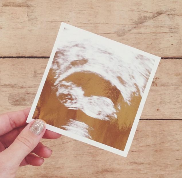 O prezentatoare celebră, însărcinată pentru prima dată. Anunţul a fost făcut în urmă cu puţin timp 