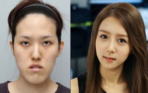 "Minunile" chirurgiei estetice. Cele mai provocatoare intervenţii - transformările, uluitoare!