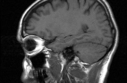 "Femeia asta nu ar trebui să fie în viaţă!" Ce au descoperit medicii la radiografie