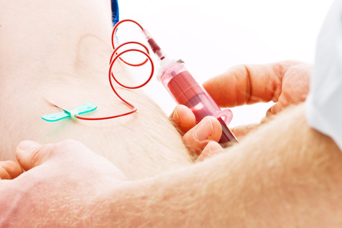 Proiect controversat. Ce se întâmplă dacă o persoană în vârstă primește sânge de la un donator tânăr