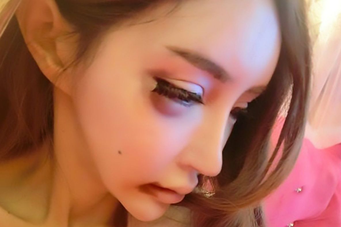 Tânără bătută crunt de iubitul "sponsor". I-a plătit operaţii estetice în valoare de 120.000 de euro