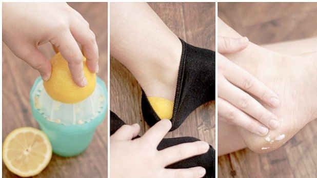 Şi-a pus o coajă de lămâie pe călcâie şi şi-a tras şosetele în picioare! Efectul e uimitor