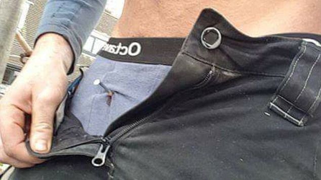 Tânăr la un pas de moarte, după ce şi-a înfipt un cui la câţiva milimetri de organul reproducător