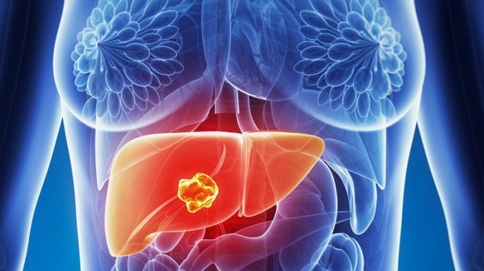 Cinci semne care arată probleme grave cu FICATUL. Mergi de urgenţă la medic!