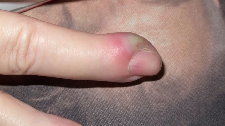 De ce nu este bine să-ţi tai colţurile unghiilor