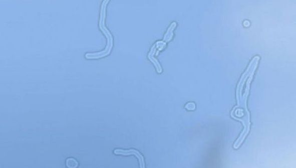 Vezi aşa ceva în faţa ochilor? Uite ce este în neregulă cu tine!