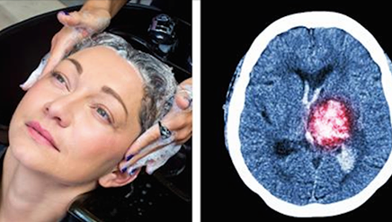 A fost la un pas de moarte după ce și-a spălat părul la un salon de frumusețe. Ce s-a întâmplat