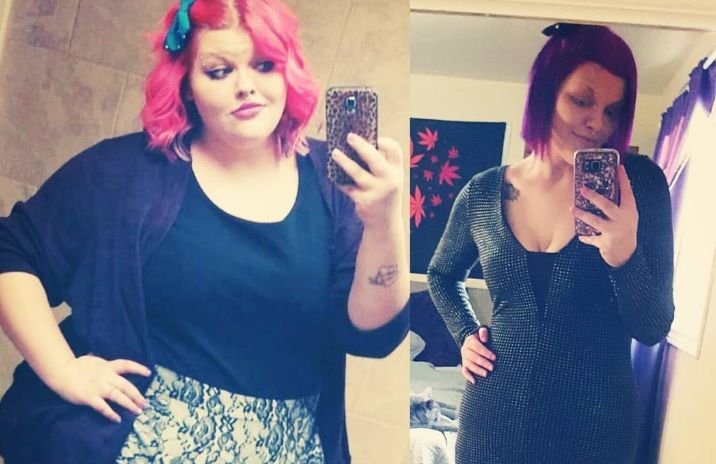 A pierdut 84 kg într-un timp record. Cum arată această fată dezbrăcată e ŞOCANT. Regretă că a slăbit