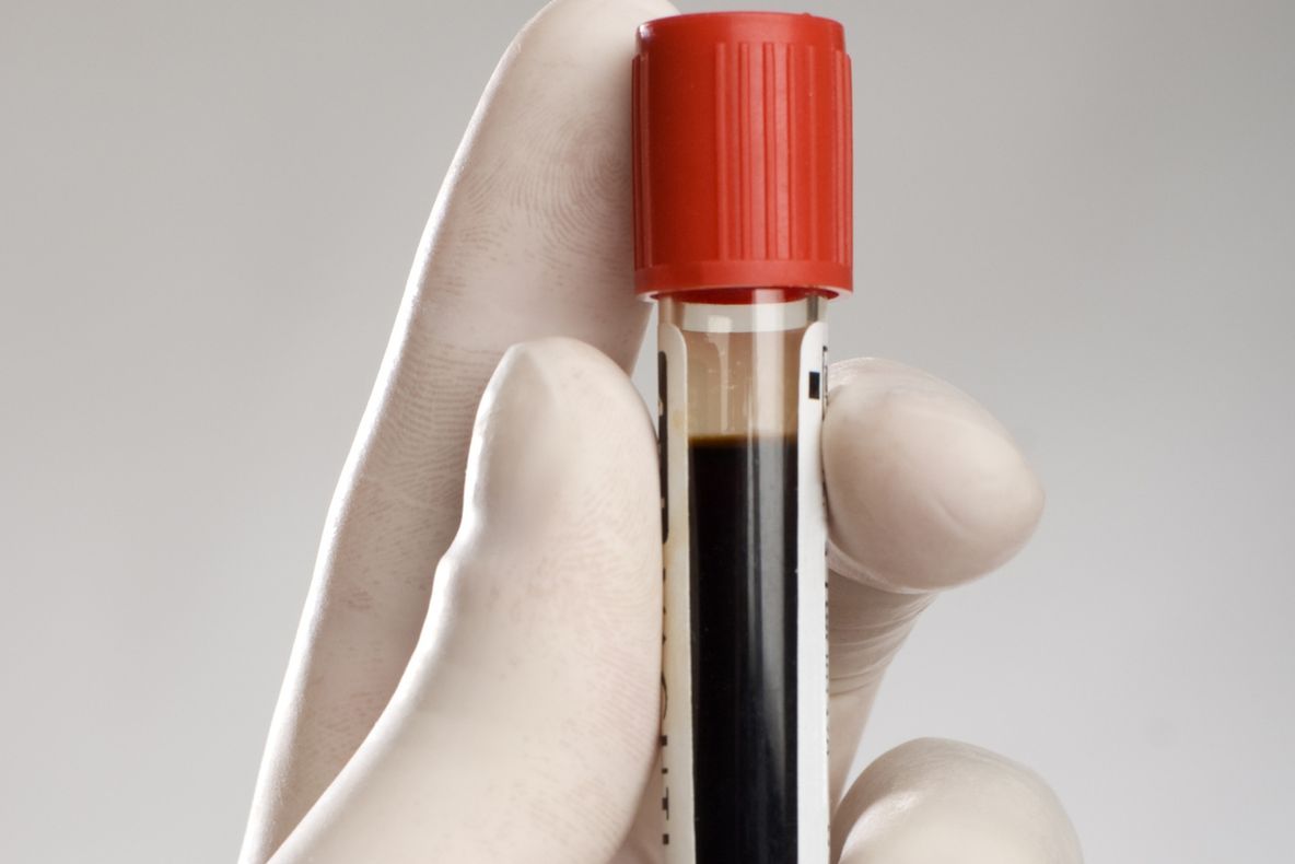 Ce se întâmplă în organismul tău când donezi sânge. Până şi medicii sunt uimiţi