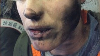 Incendiu din senin în avion. Înfiorător ce a pățit această femeie care dormea în timpul zborului!