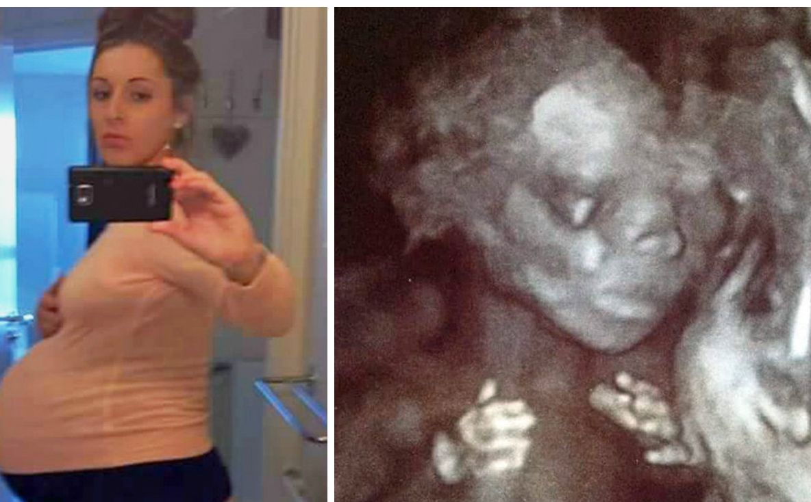 A acceptat să fie mamă surogat la doar 21 de ani. La prima ecografie, doctorii au rămas fără cuvinte