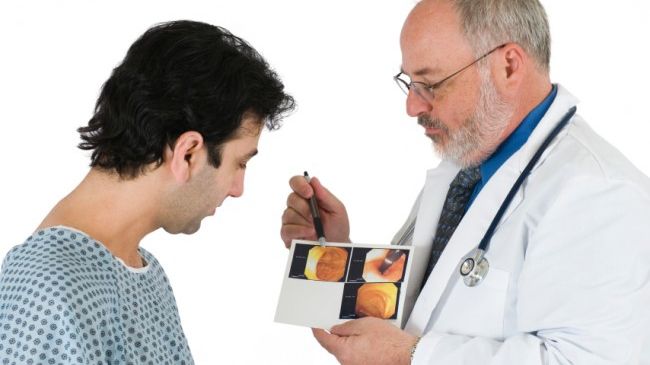 Patru semne ale cancerului de colon pe care toată lumea le ignoră