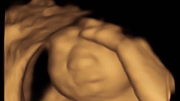 Ecografia arăta că bebelușul nu va trăi. Părinții au decis să meargă mai departe. E IREAL ce a urmat