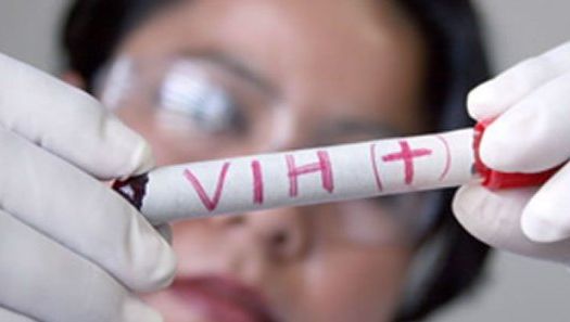 Ai aceste simptome? Mergi de urgenţă la medic! Ai putea fi infectat cu HIV