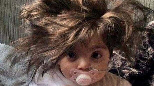 Fetiţa de opt luni pe care mulţi o confundă cu o păpuşă 