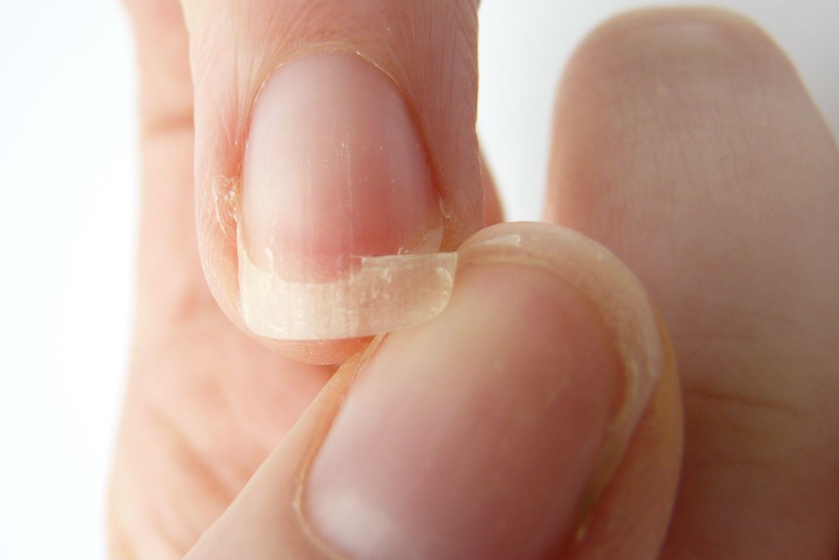 Nu poţi dormi, ţi se rup unghiile şi îţi cade parul? Uite ce deficienţă uriaşă ai!