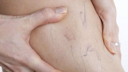 Ai probleme cu circulaţia sângelui? Iată cum poţi rezolva problema în numai 10 minute