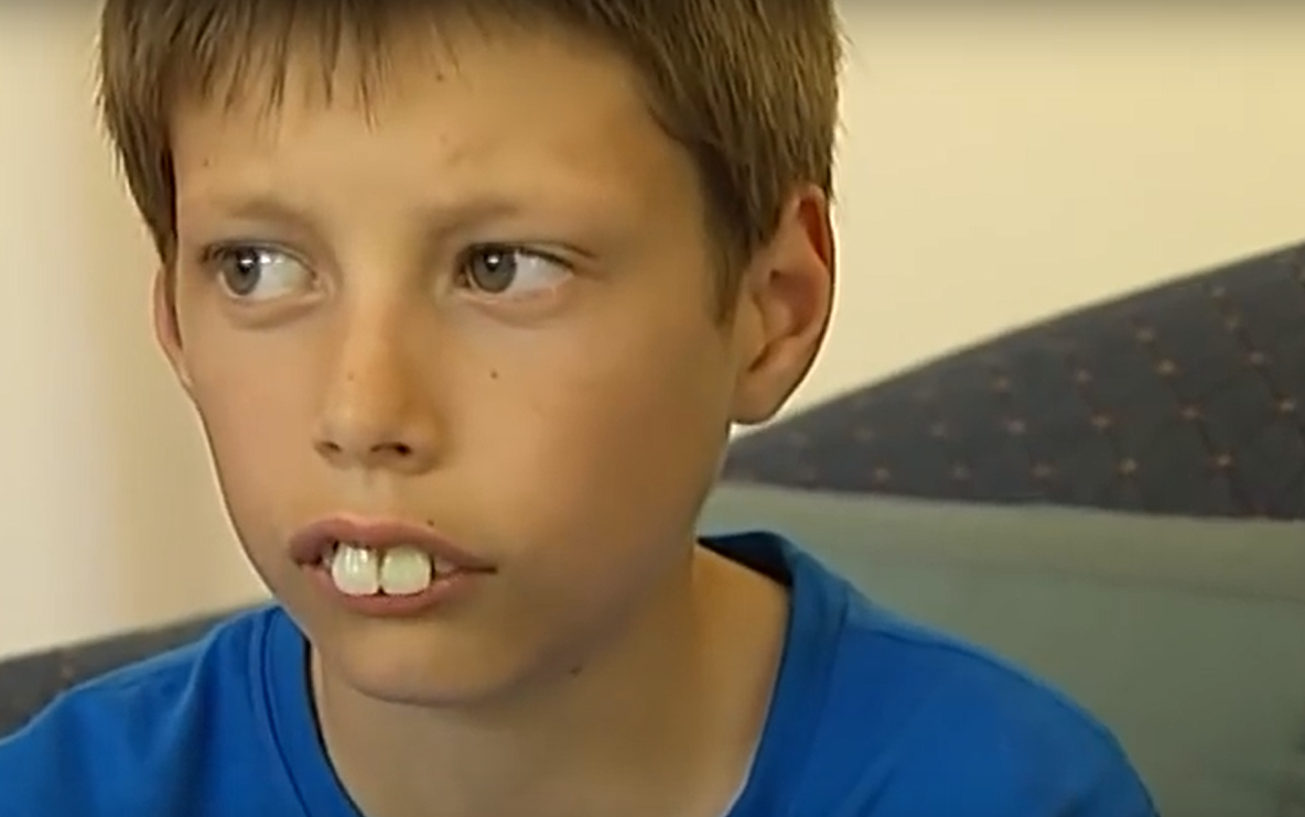 El e copilul poreclit "Puştiul-iepure". Cum arată după ce a suferit operaţii ce au costat 100.000 $