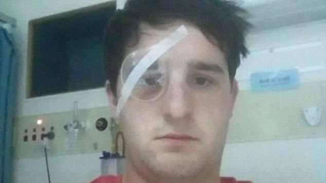 SCANDAL: un fotbalist dă în judecată fostul club, după ce a pierdut un ochi. Un oficial e de vină!