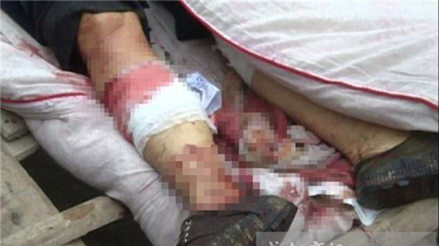 O femeie a murit, după ce soţul i-a tăiat picioarele! Tragedia care a îngrozit comunitatea