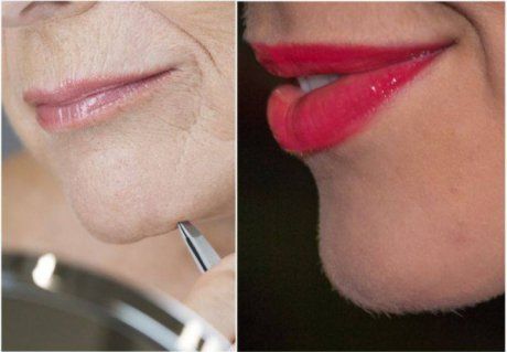 Eşti femeie şi ţi-au apărut fire de păr în barbă? Mergi la medic urgent. Suferi de această boală!