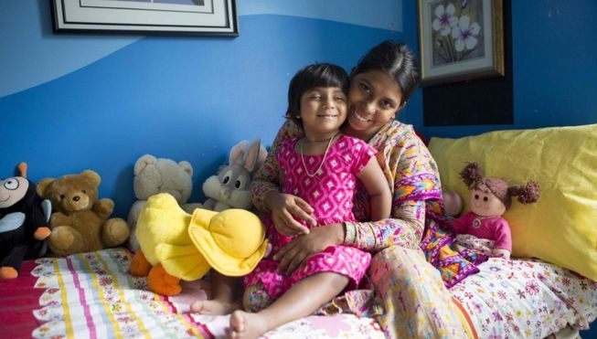 Fata cu trei picioare a fost operată cu succes. Rezultatele sunt peste așteptările chirurgilor