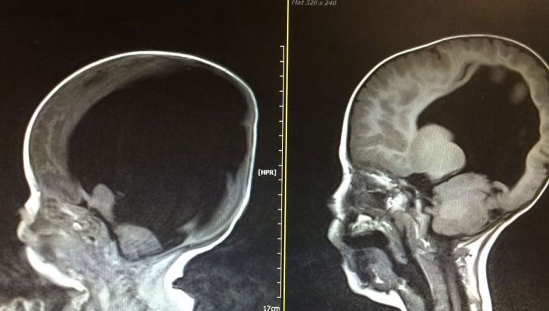 Medicul a sfătuit-o să întrerupă sarcina. Mama a spus: "Nu pot face asta". Ce a urmat, şocant!