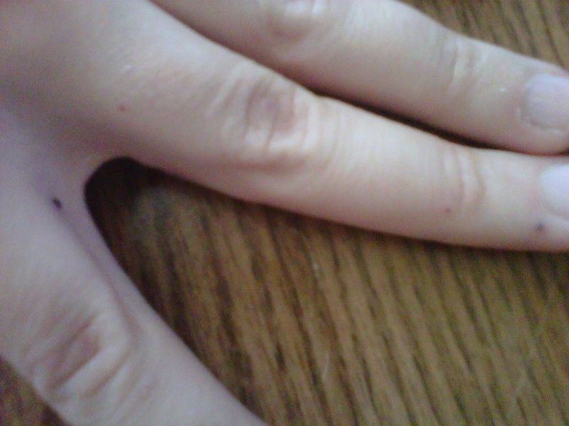 A observat câteva pete negre pe mâna soţiei sale. Ce s-a dovedit că sunt...Dumnezeule! 