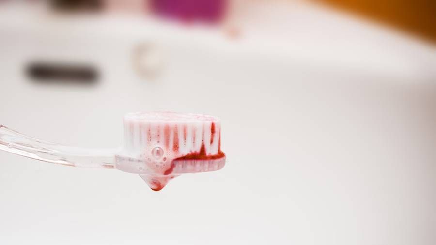 Îţi sângerează gingiile? Poţi suferi de aceste boli! Mergi la medic de URGENŢĂ