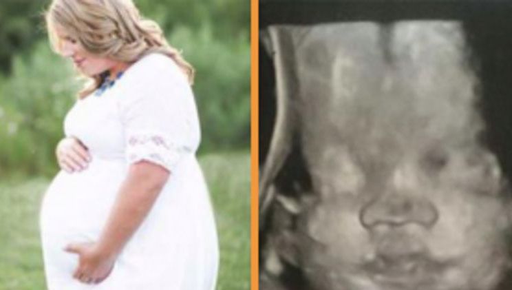 I-a spus soțului că e însărcinată chiar la înmormântarea lui. Apoi, ceva cumplit s-a întâmplat