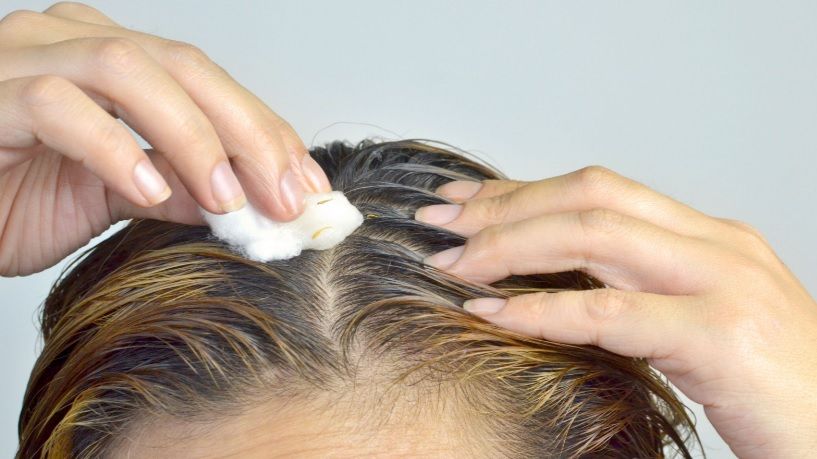 Cum să scapi de MĂTREAŢĂ cu tratamente de pe vremea bunicii. Remediile, 100% naturiste