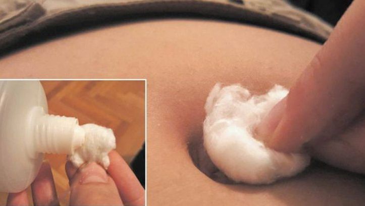 Şi-a pus puţină vată cu spirt în buric. Motivul te va surprinde
