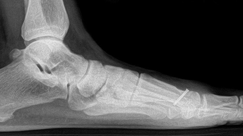 Părinții au rămas șocați, când au aflat adevărata cauză a decesului fiului lor!