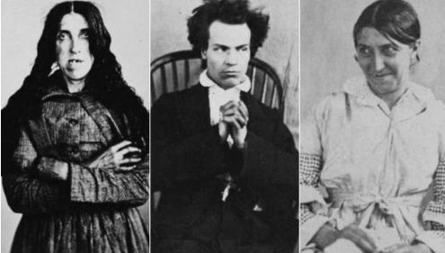 Fotografii bântuitoare din secolul XIX dintr-un spital de psihiatrie. Sunt greu de privit!