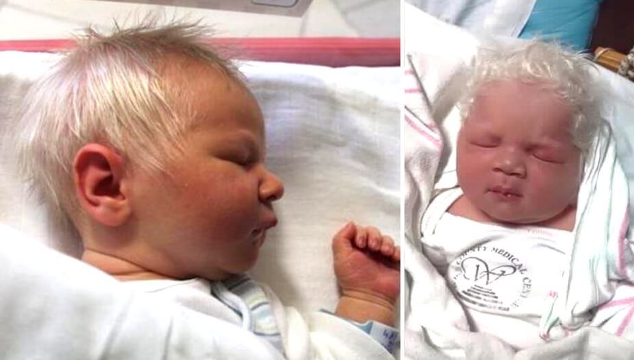 Bence, copilul cu păr alb care i-a uimit pe medici