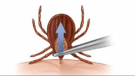 A reînceput "invazia" CĂPUŞELOR în parcuri! Cum îndepărtezi o căpuşă simplu şi în siguranţă. VIDEO