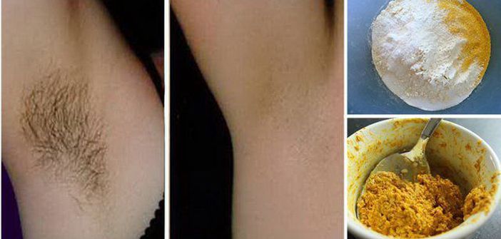 Cum poţi scăpa de părul de la subraţ chiar la tine acasă! O soluţie naturală 100%