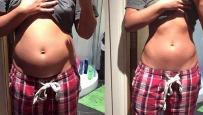 Cum să scapi rapid de balonare! Metoda este REVOLUȚIONARĂ