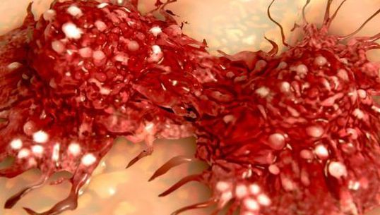 Descoperire şocantă: acesta este lucrul care îţi creşte cancerul în corp