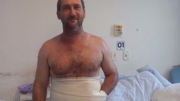 A suferit un accident teribil. Ce decizie uluitoare a luat medicul pentru a-i salva braţul mutilat