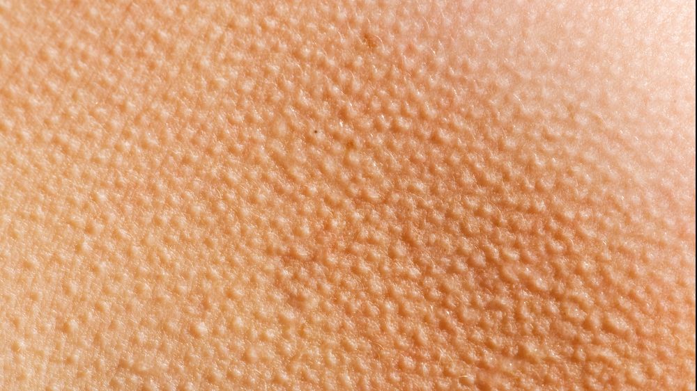 Ți se face des pielea ”de găină”? Mergi la un control medical. Ce afecțiune poți avea