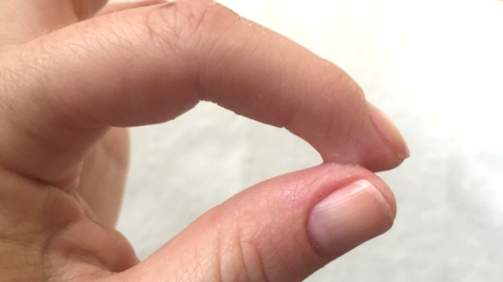 Cum poţi scăpa de super glue-ul de pe piele sau alte suprafeţe 