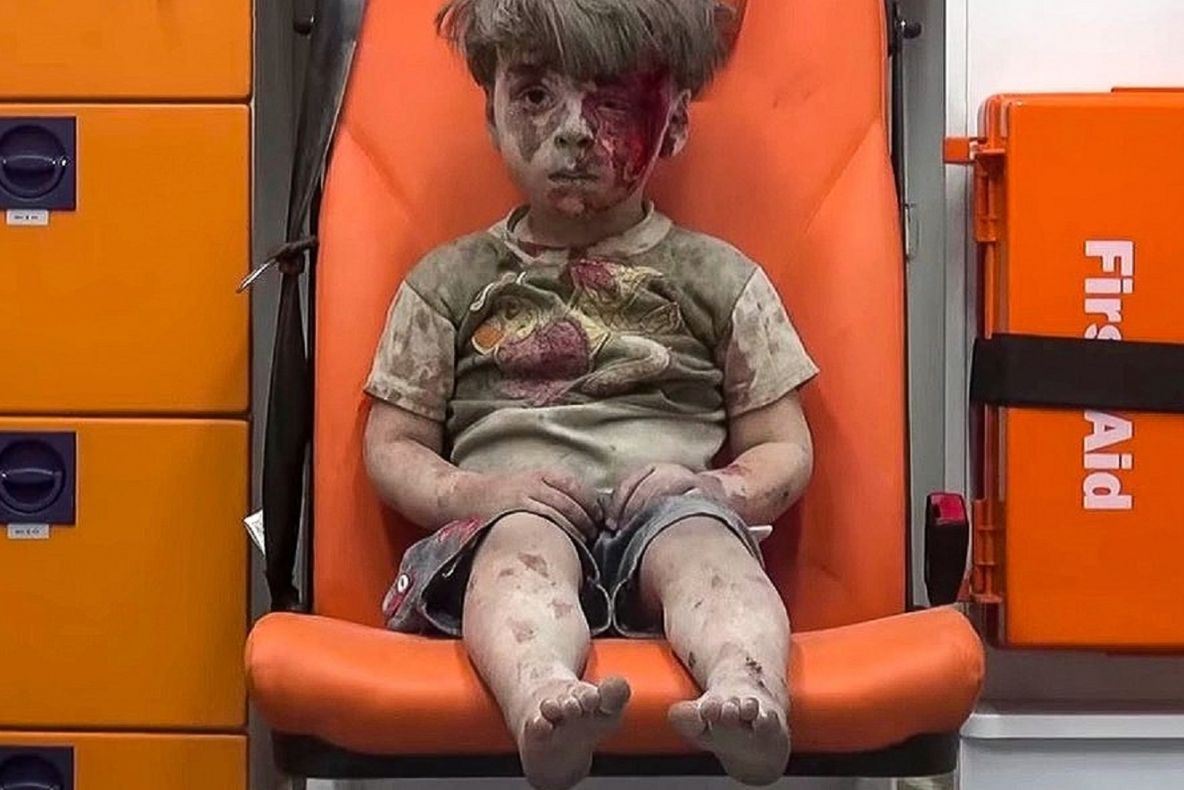 Cum arată azi copilul din Alep care a impresionat o lume întreagă după atacul aerian