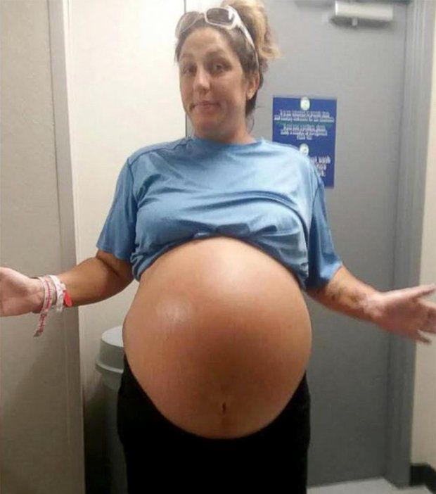 Medicii, șocați. N-au mai văzut așa ceva. Cum arată o fetiță născută prin cezariană