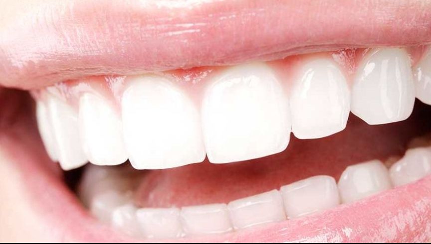 Una dintre cele mai inovatoare proceduri stomatologice în privința implanturilor