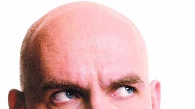 Ce boli cumplite poate ascunde chelia. Sigur nu știai asta