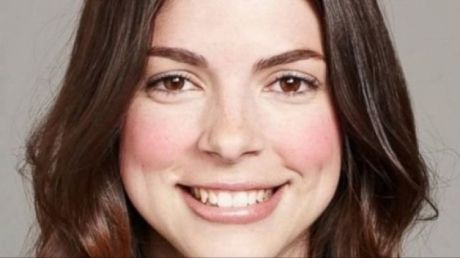 A plecat la plajă, dar a uitat să se dea cu cremă pe faţă. E cutremurător cum a ajuns să arate