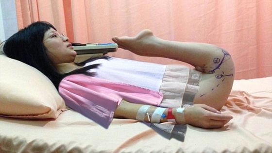 Vecinii o numeau “fata care se târăște”. La 26 de ani, a mers pentru prima dată