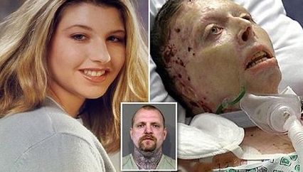 Era de o frumuseţe rară. Iubitul ei a turnat benzină pe ea şi i-a dat foc. Ce a urmat, e ireal