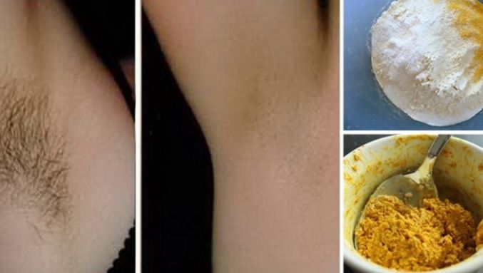 Cum să scapi de părul de la subraţ. Definitiv!